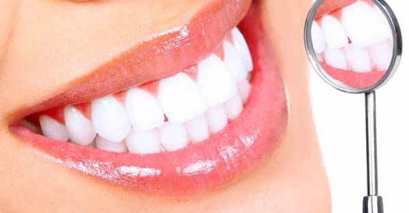 diş beyazlatma nasıl yapılır